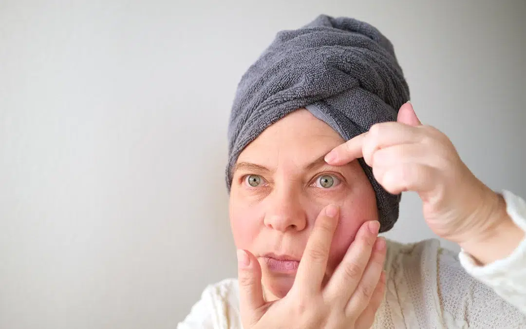 Eyelids Sag and Get Puffy with Age