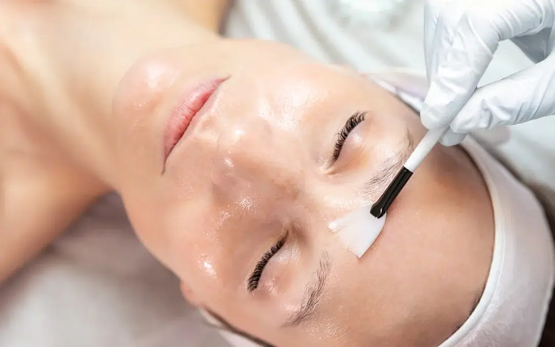 Our Chemical Peels Are An Excellent Choice For Your Skin