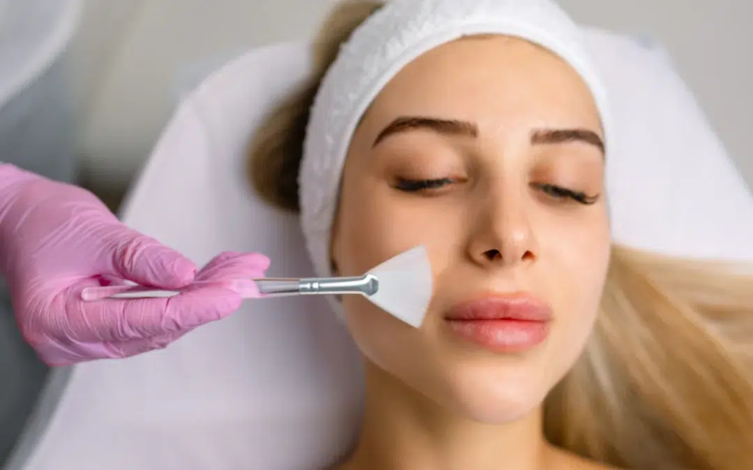 Chemical Peel Special Procedures
