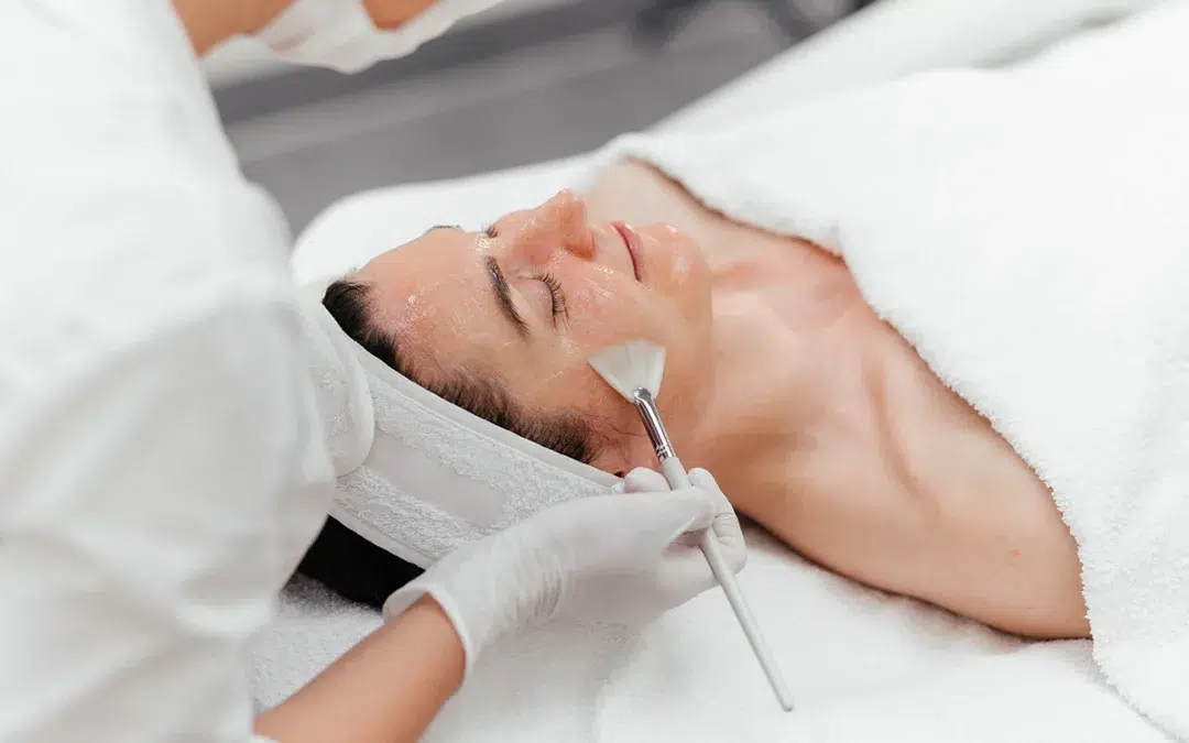 Chemical Peels Skin Treatment