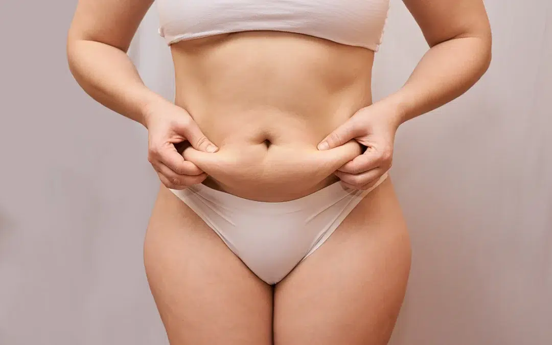 Beat Stubborn Fat with Liposuction