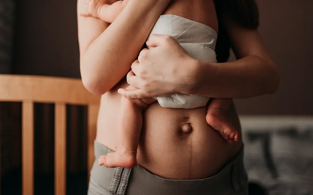 Mommy Makeover – Cosmetic Surgery – Minneapolis