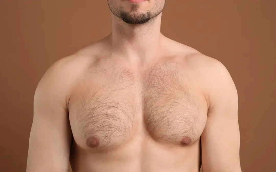 We Use Male Breast Reduction to Recontour and Sculpt Your Chest