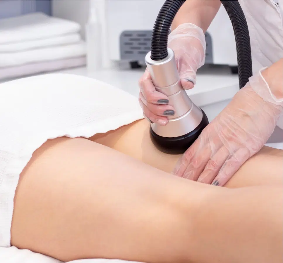 woman receiving cellulite reduction treatment woman receiving cellulite reduction treatment