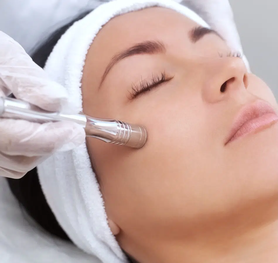 woman receiving microdermabrasion treatment