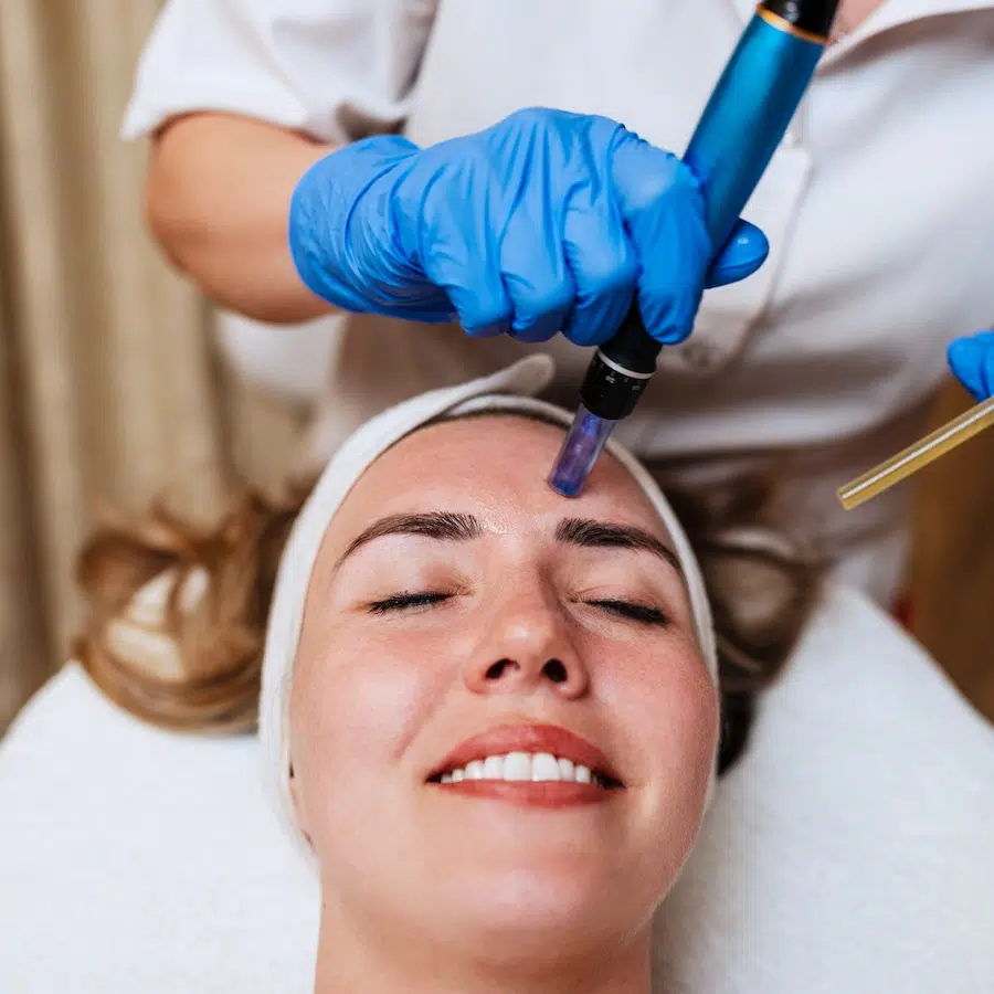 woman receiving microneedling treatment