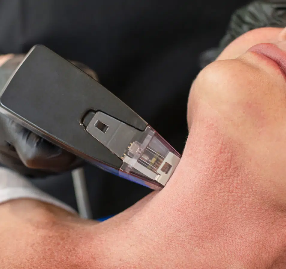 woman receiving morpheus treatment woman receiving morpheus treatment