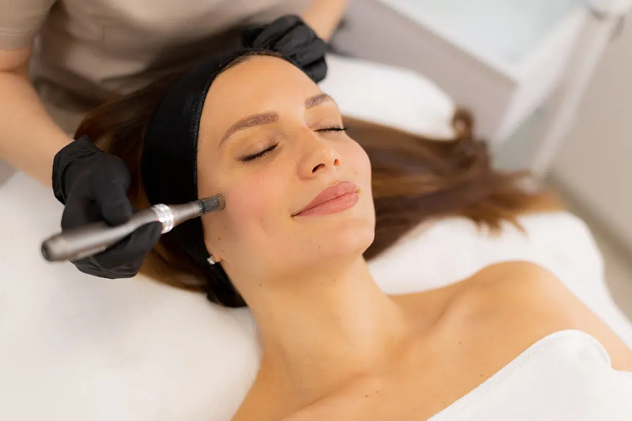 Esthetician in black gloves performing a microneedling treatment on a relaxed woman's cheek in a medical spa. Esthetician in black gloves performing a microneedling treatment on a relaxed woman's cheek in a medical spa.